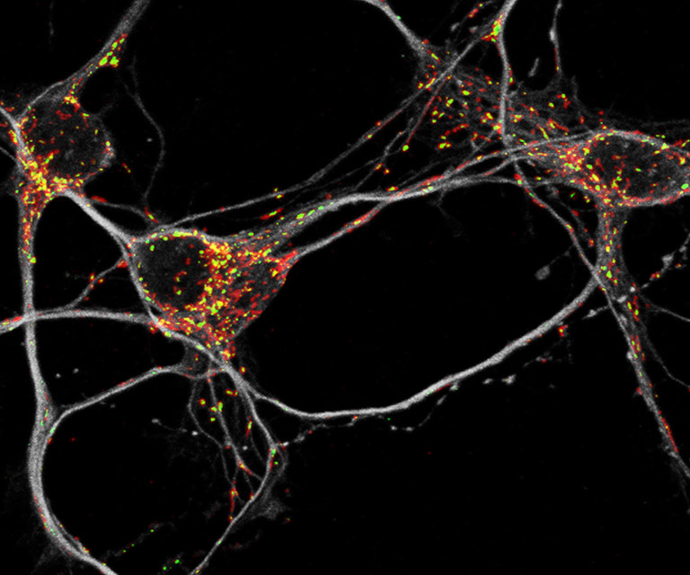 Nervenzellen Mit Energie Sparprogramm Kolner Wissenschaftsrunde